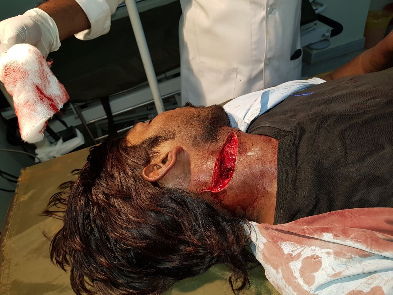 अंडे लारी वाले ने हॉस्टल ड्राइवर को मारा चाकु: किचन गार्डन, माउंट आबू