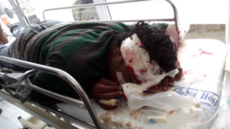 बाइक पर सवार तीन जनो का हुआ एक्सीडेंट: माउंट आबू