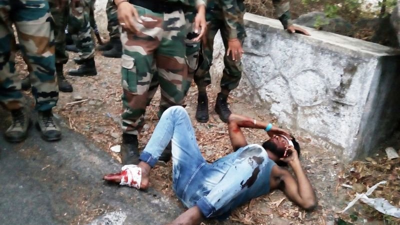 माउंट आबू मार्ग पर बाइक एक्सीडेंट में चोटिल की आर्मी ने की फर्स्ट एड से मदद, 108 फिर नोट रीचेबल