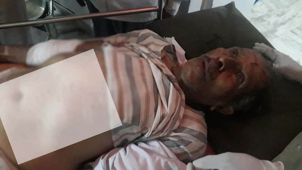 आज फिर हुआ भालू का हमला, इस बार ज्ञानसरोवर मार्ग पर वृद्ध पर हुआ हमला